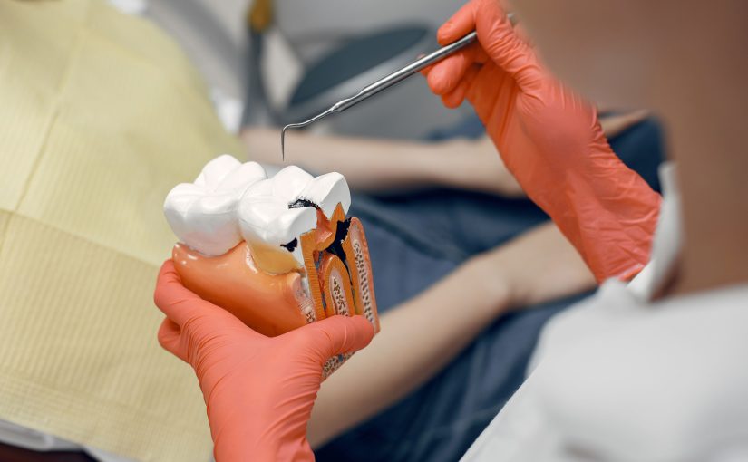 ROOT CANAL TREATMENT