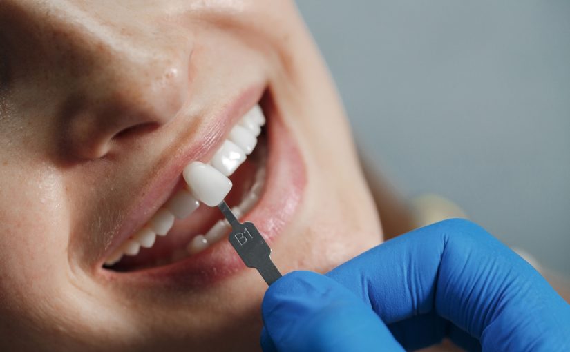 How to Choose the Best Dental Clinic in Madurai for Your Family