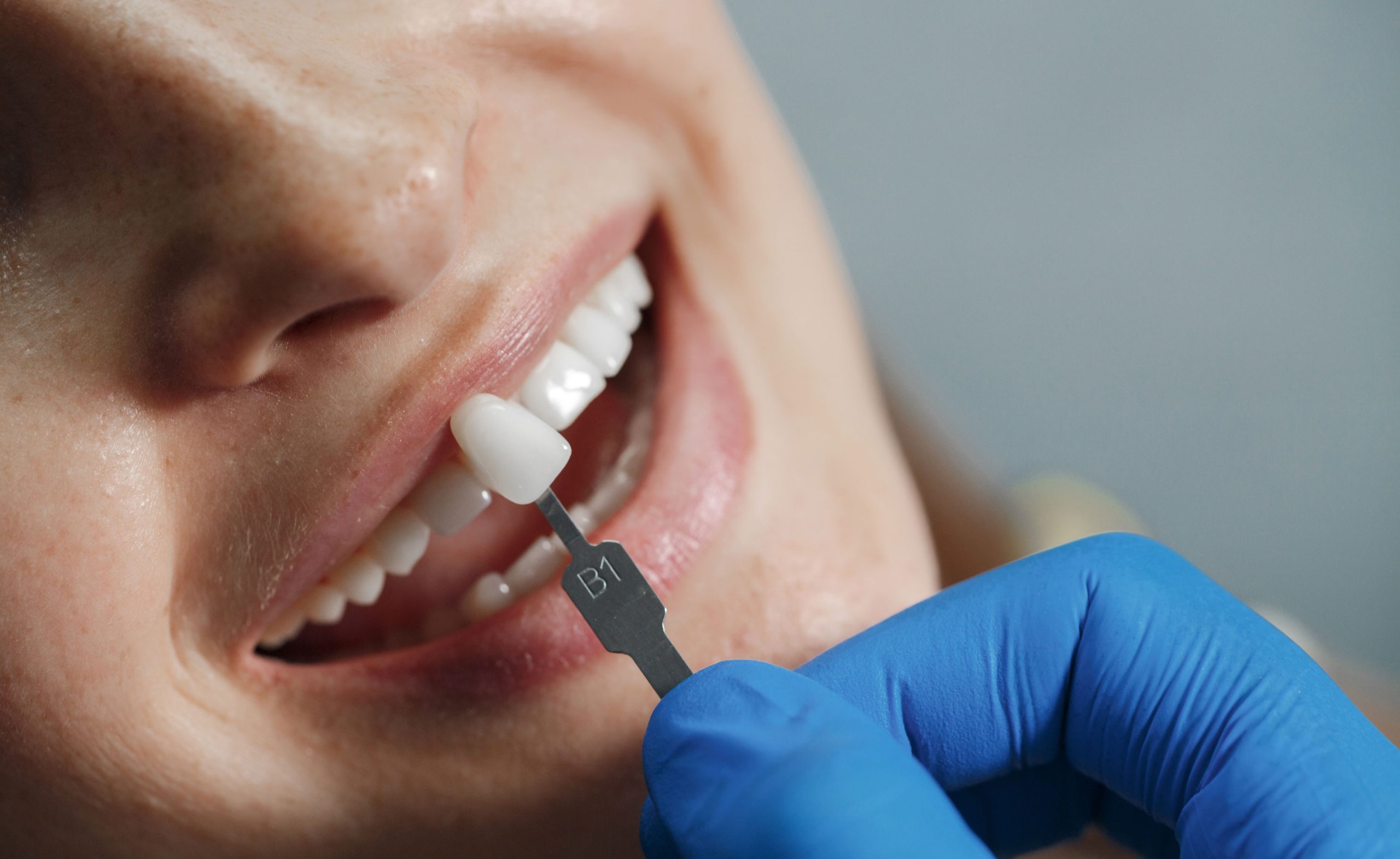 How to Choose the Best Dental Clinic in Madurai for Your Family