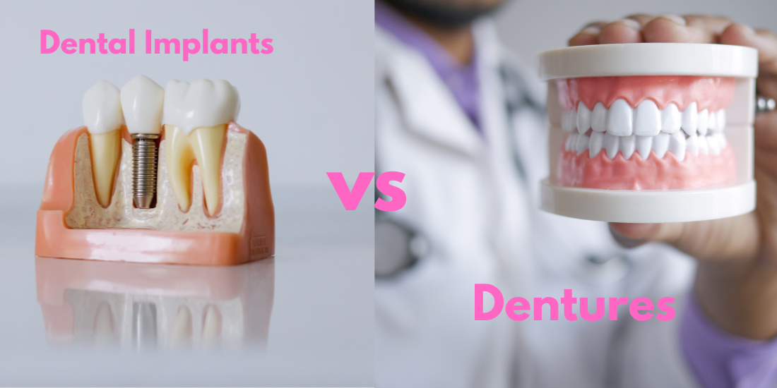 Dental Implants vs Dentures: Which Option Is Better for You?