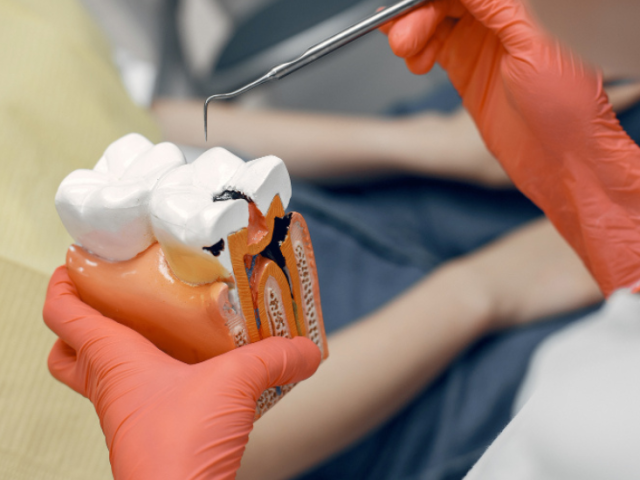 Top 10 Signs You Need a Root Canal Treatment