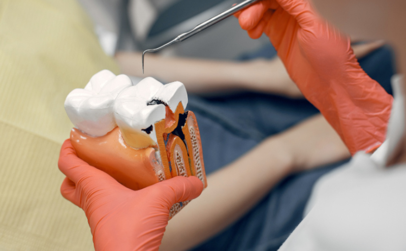 Top 10 Signs You Need a Root Canal Treatment