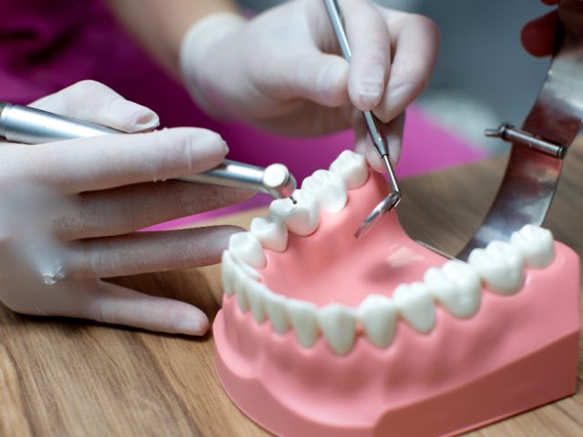 Why Delaying a Missing Tooth Replacement Can Cost You More Than You Think