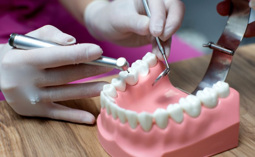 Why Delaying a Missing Tooth Replacement Can Cost You More Than You Think