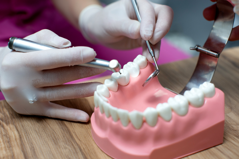 Tooth Replacement