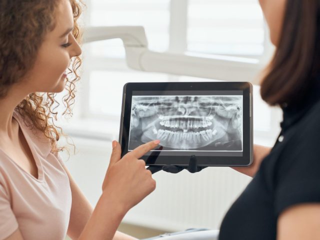 No More Trays: The Rise of 3D Digital Scanning in Modern Dentistry