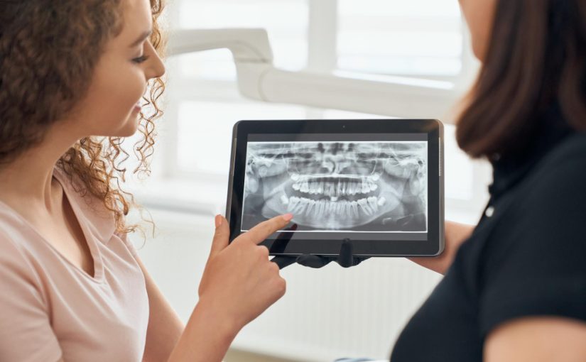 No More Trays: The Rise of 3D Digital Scanning in Modern Dentistry